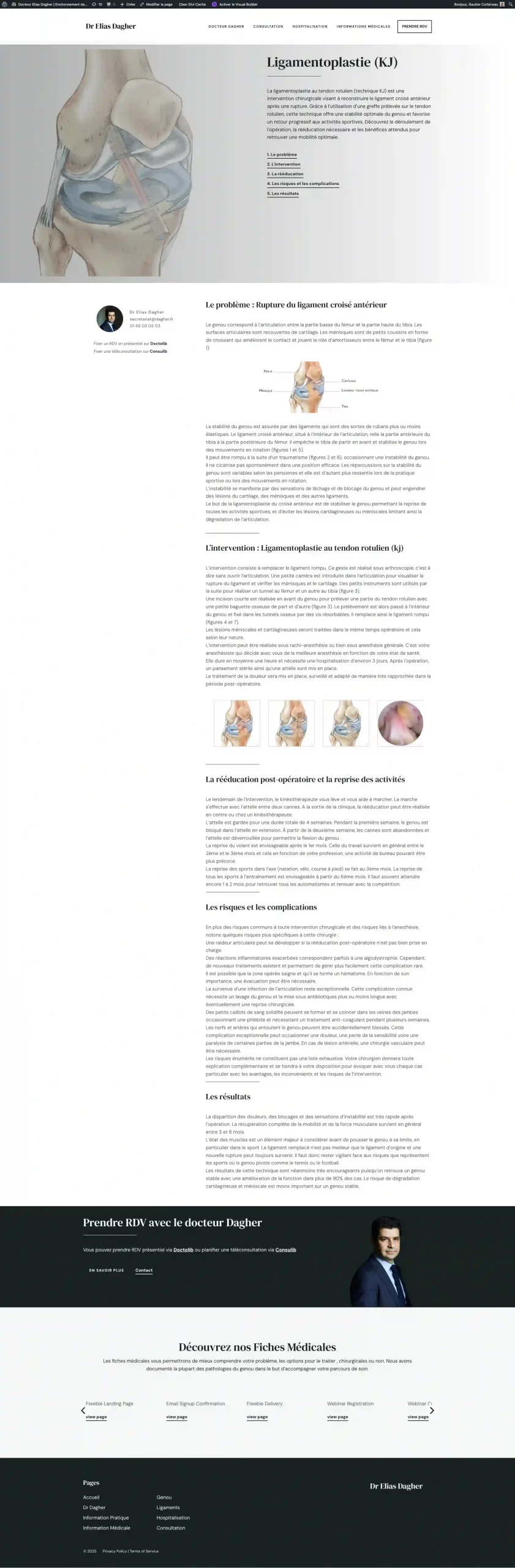 Ligamentoplastie (KJ) - Docteur Elias Dagher - Environnement de Test_ - gekomed.live-website.com