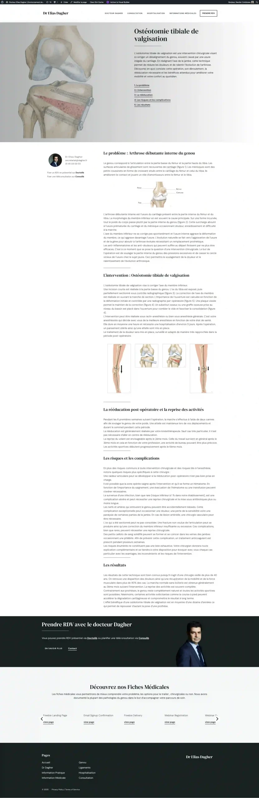 Ostéotomie tibiale de valgisation - Docteur Elias Dagher - Environnem_ - gekomed.live-website.com