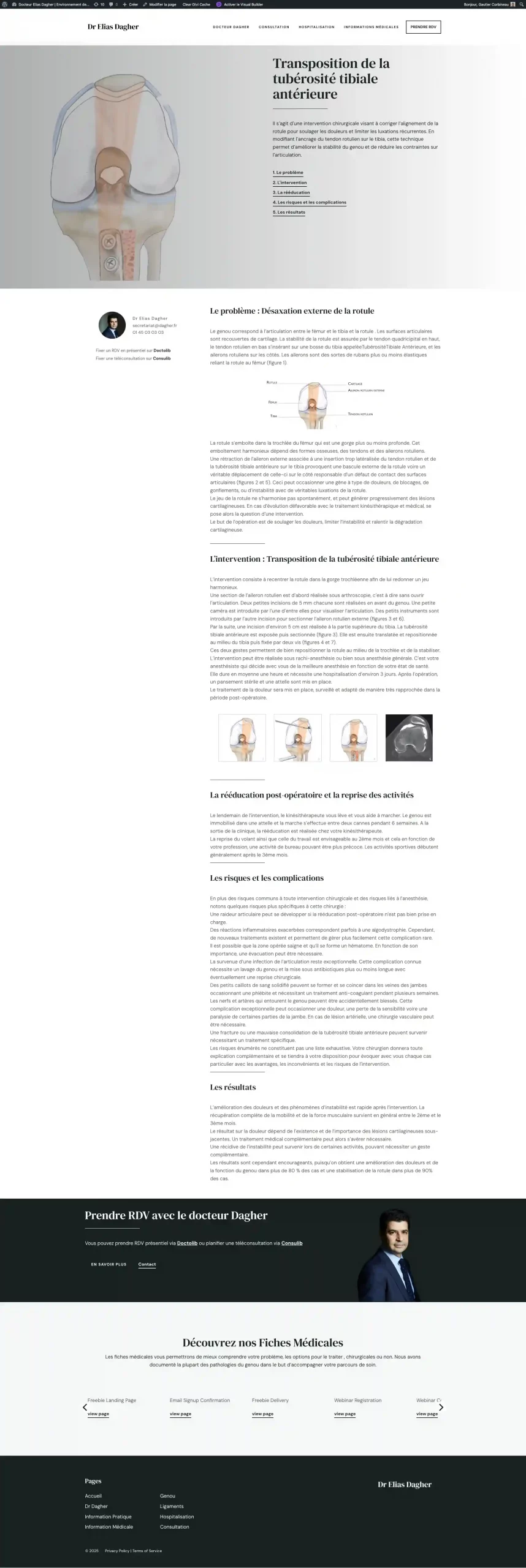 Transposition de la tubérosité tibiale antérieure - Docteur Elias Dag_ - gekomed.live-website.com